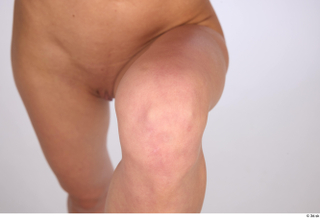 Riva knee 0002.jpg